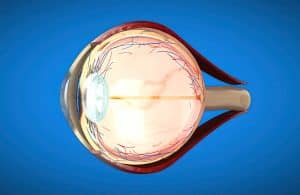 operacion desprendimiento de retina